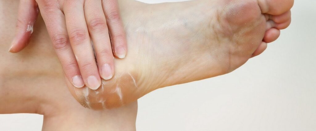 Comprendre les Pieds Diabétiques : Causes, Symptômes et Prévention